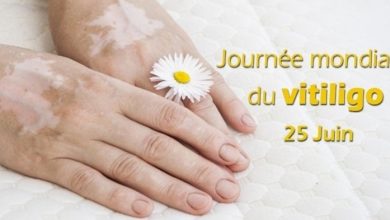 L’Arabie saoudite célèbre la Journée mondiale du vitiligo