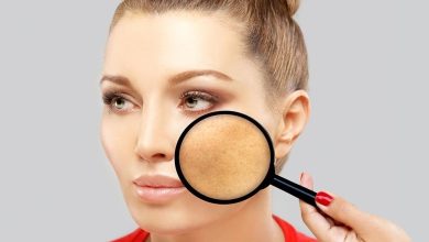 Éliminez les taches sombres : 4 ingrédients puissants