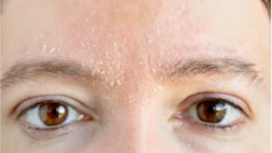 Les acariens du visage expliqués