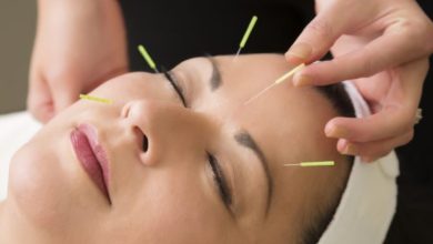 L'acupuncture esthétique va-t-elle détrôner Botox et injections ?