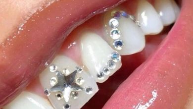 Cristaux dentaires : entre élégance et prudence sanitaire