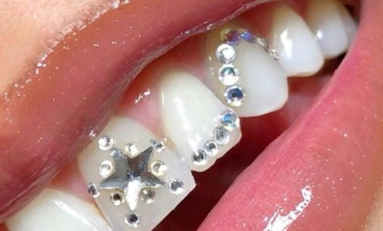 Cristaux dentaires : entre élégance et prudence sanitaire