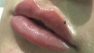 Tendance du tatouage de grain de beauté