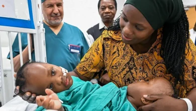 Réussite de l’opération de séparation des jumelles siamoises tanzaniennes